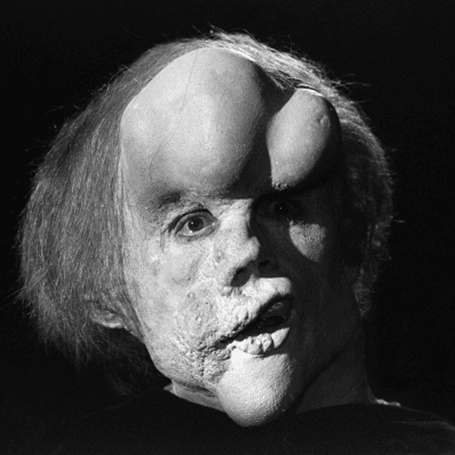 elephant man
